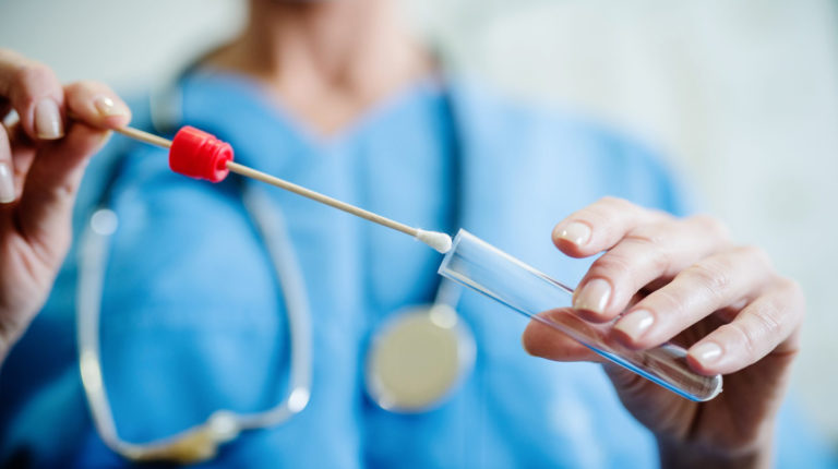 I test sierologici fatti dai privati? Creano confusione